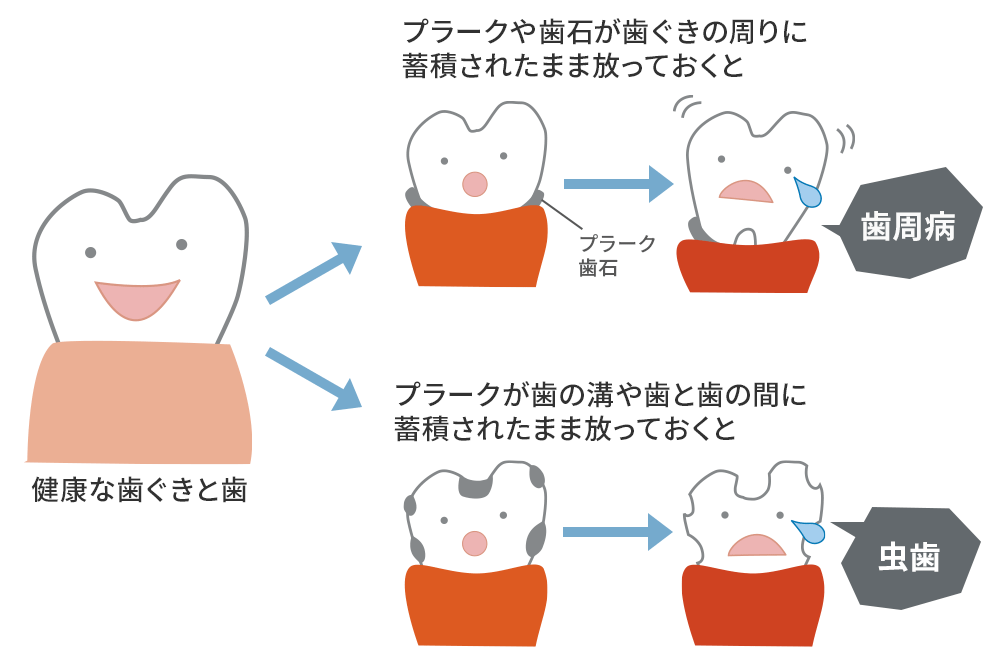 プラーク